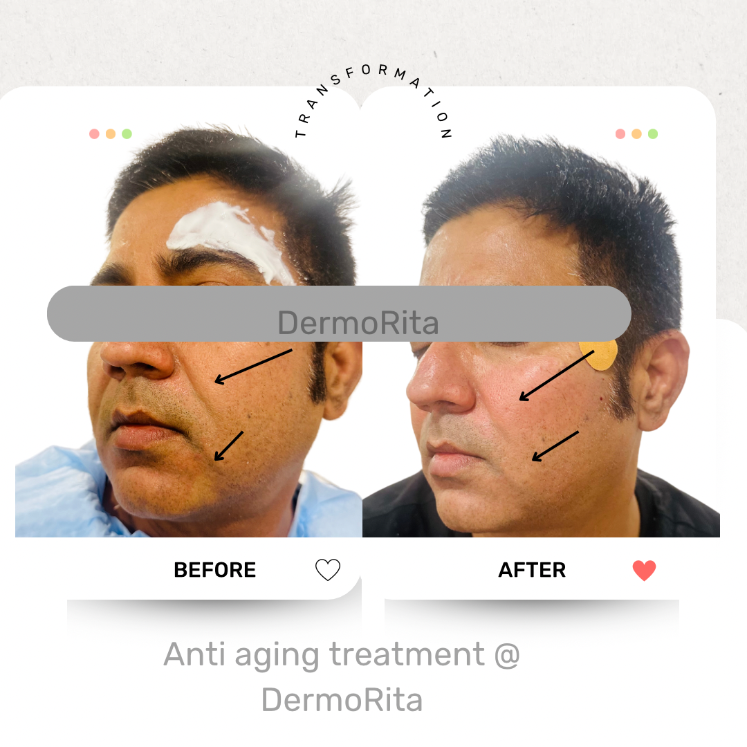 Beige Minimalist Before and After Makeup Transformation Instagram Post
